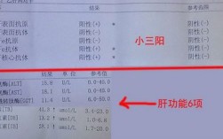 公务员考试中有乙肝小三阳体检会合格吗？（肝功能不合格单位要吗）