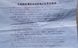 医院查到我有艾滋病会不会公开？（查出艾滋病告知单位）