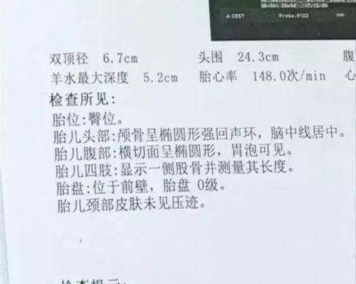 事业单位怀孕前三个月有保胎假？事业单位工作保胎-图1