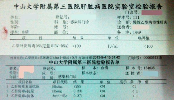 中铁十五局体检出乙肝怎么办？（单位体检乙肝怎么办）-图3