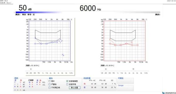 纯音听阈均值怎么看？（纯音测听单位）-图1